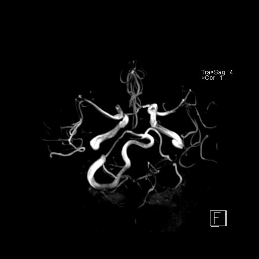 Click on the Serie image to view the images of VILLANUEVA, WILLIAM A.